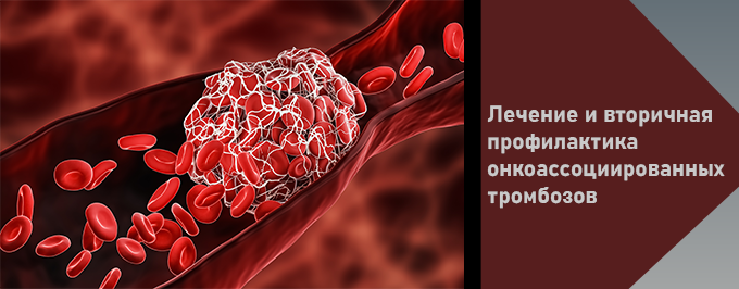 Лечение и вторичная профилактика онкоассоциированных тромбозов