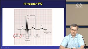 ЭКГ- это интересно!