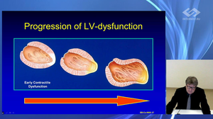 Разбор клинических случаев пациентов с сердечной недостаточностью. Опыт Кардиологического центра Германии