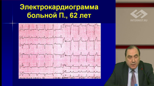 V Международный Интернет Конгресс специалистов по внутренним болезням. День 1. Симпозиум Общества специалистов по сердечной недостаточности. Лекция Мастер-класс