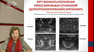 V Международный Интернет Конгресс специалистов по внутренним болезням. День 3. Симпозиум с участием эксперта Ассоциации ревматологов России