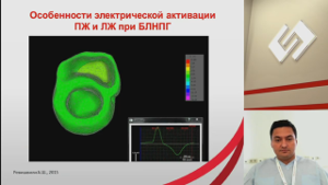 Неэффективная сердечная ресинхронизирующая терапия. Сложности ведения пациентов. Пути решения. 