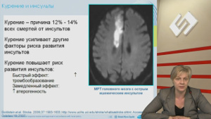 Реальный пациент у кардиолога. Как предотвратить инсульт?  