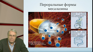 V Международный Интернет Конгресс специалистов по внутренним болезням. День 3. Симпозиум с участием эксперта Ассоциации колопроктологов России