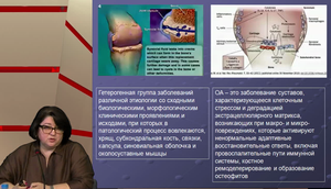 XLIX Всероссийская Образовательная Интернет Сессия для врачей. Секция НЕВРОЛОГИЯ