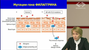 Аллергодиагностика: от простого к сложному