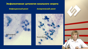 Ответы аллерголога на вопросы, которые часто задают клиницисты