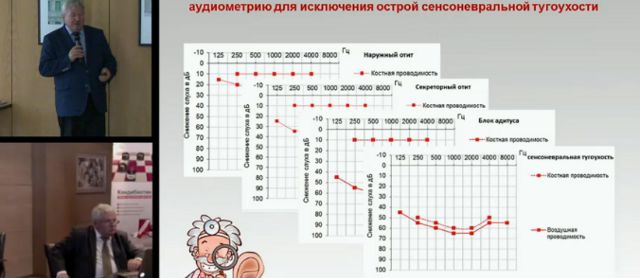 Рекомендации лечения наружных и средних отитов: диагностика и лечение, разбор клинических случаев