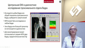 Денситометрия как оценка риска развития остеопороза. Разбор клинического случая