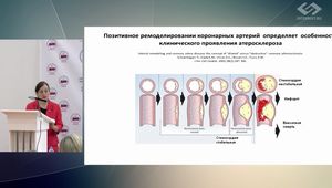 Современные лабораторно-диагностические маркеры в оценке патогенеза сердечно-сосудистых заболеваний