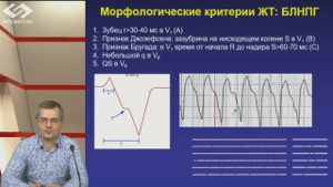 ЭКГ-это интересно!