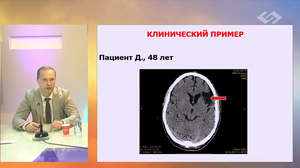 Практические вопросы применения пероральных антикоагулянтов у больных инсультом