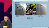Новости доказательной кардиологии