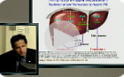 Pharmacologic treatment of NASH (english).