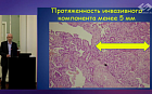 Рак легкого. Новое в гистологической классификации и морфологической диагностике