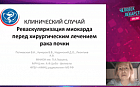 Реваскуляризация миокарда перед хирургическим лечением рака почки.